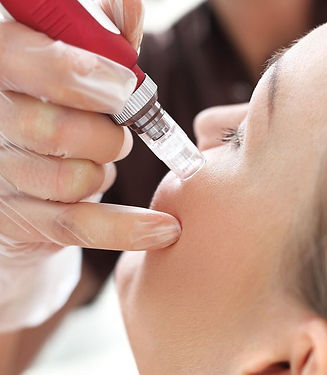 dermapen 2.jpg