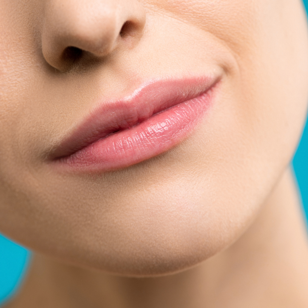 Labio superior + Mentón