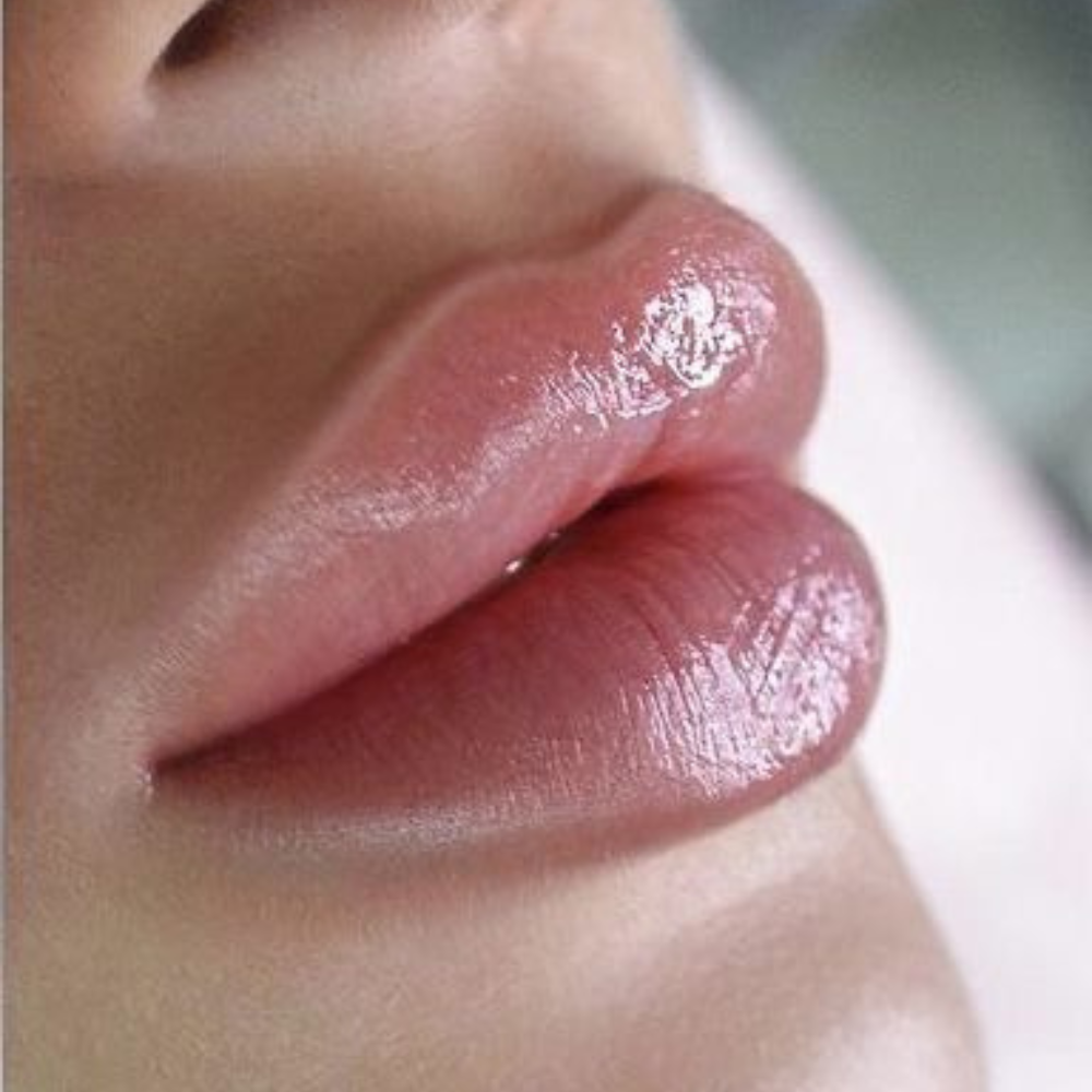 Aumento de labios