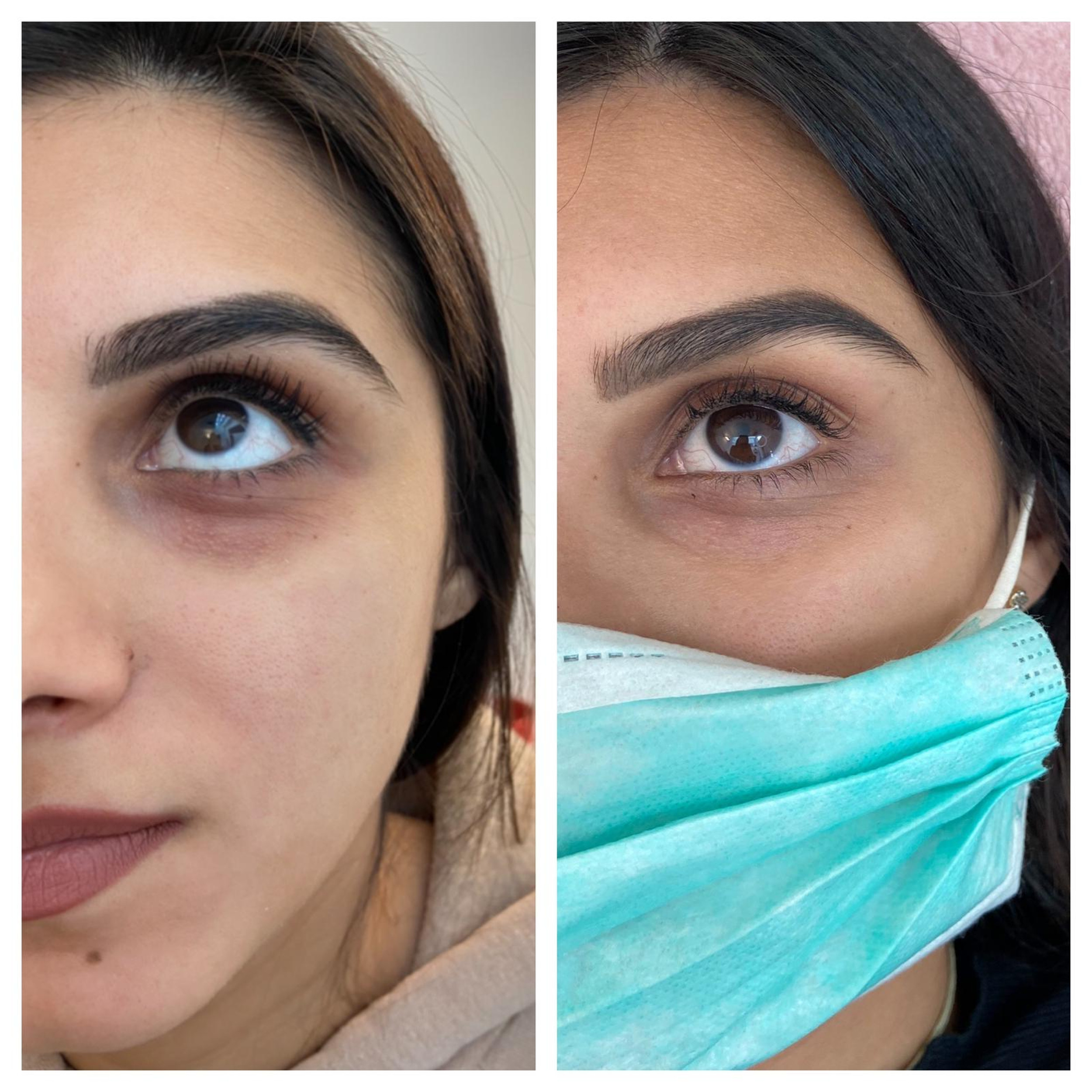 Augenringe Behandeln Mit Permanent Concealer Cc Eye In Berlin Augenringe Behandeln Mit Permanent Concealer Cc Eye In Berlin