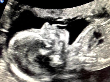 🌱 No Two Beginnings Are the Same: The "WHY" Behind Personalized Birth Education