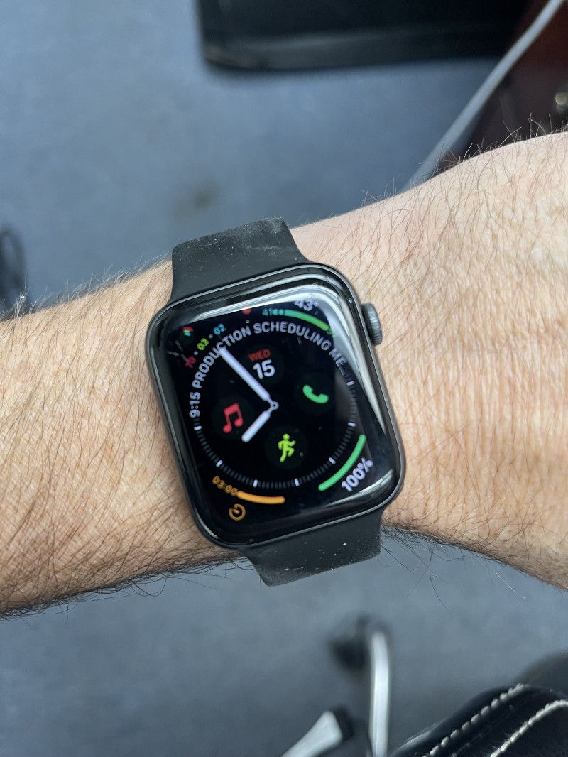A picture of the Apple watch on a person’s arm.