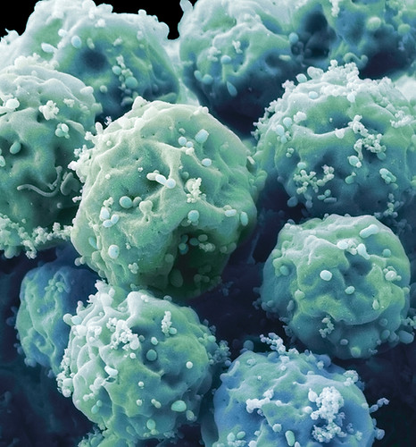 Trasplante de células madre hematopoyéticas