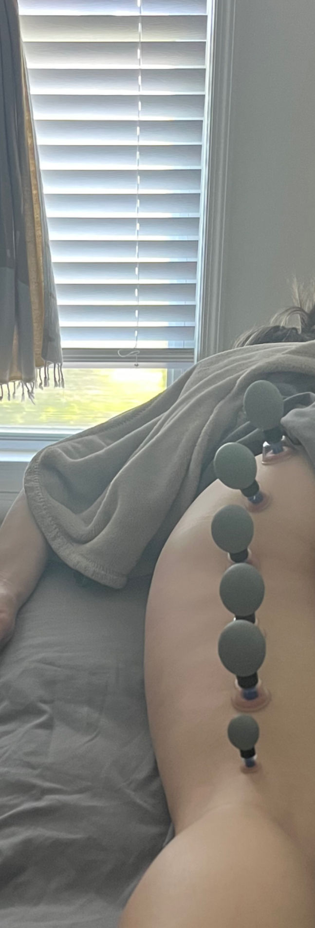 Exploring the Benefits and Contraindications of Magnetic Cupping in Massage Therapy