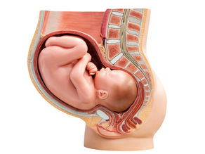 Model of baby head down in pelvis
