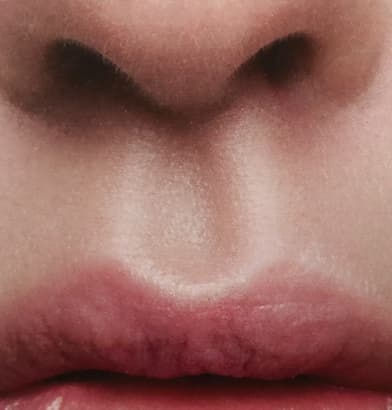 Philtrum