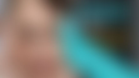 Menghilangkan Kutil Kelamin Dengan Kapur Sirih