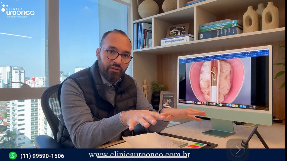 Rezum | A Revolução Silenciosa da Próstata: Como o Vapor de Água Está Transformando o Tratamento da Hiperplasia Prostática Benigna