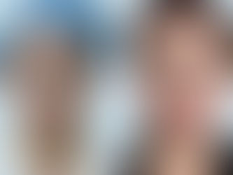 Nâng Mũi Cho Người Mũi Thấp: Phân Tích Thực Tế Theo Từng Dáng Khuôn Mặt
