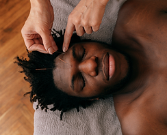 healing arts acupuncture