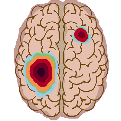 Fig1 Brain RT Redcued.tif