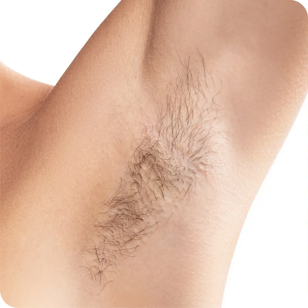 armpit before.png