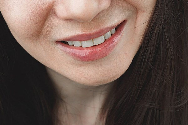 Por qué aparece la queilitis angular