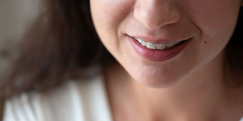 ortodoncia estructura facial