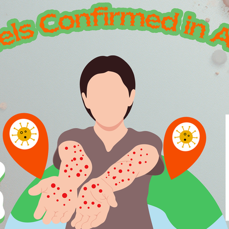 Sunshine Scoop || October 2025