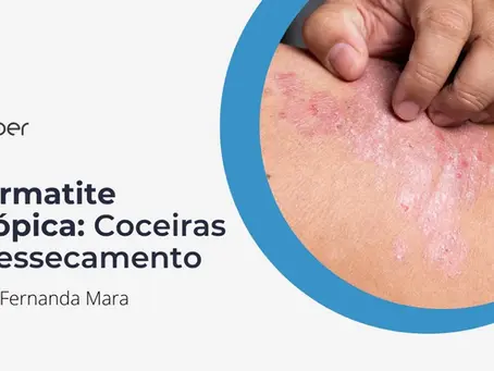 Dermatite Atópica: coceiras e ressecamento