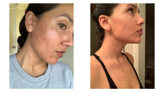 How to heal your skin with food