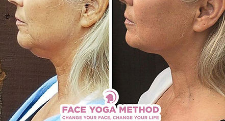 Before and After FYM