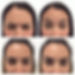 Wrinkle Reduction