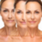 Signature Liquid Facelift