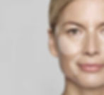 Volumisation Treatment