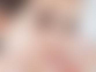 Giảm sưng nhờ chườm đá sau khi nâng mũi