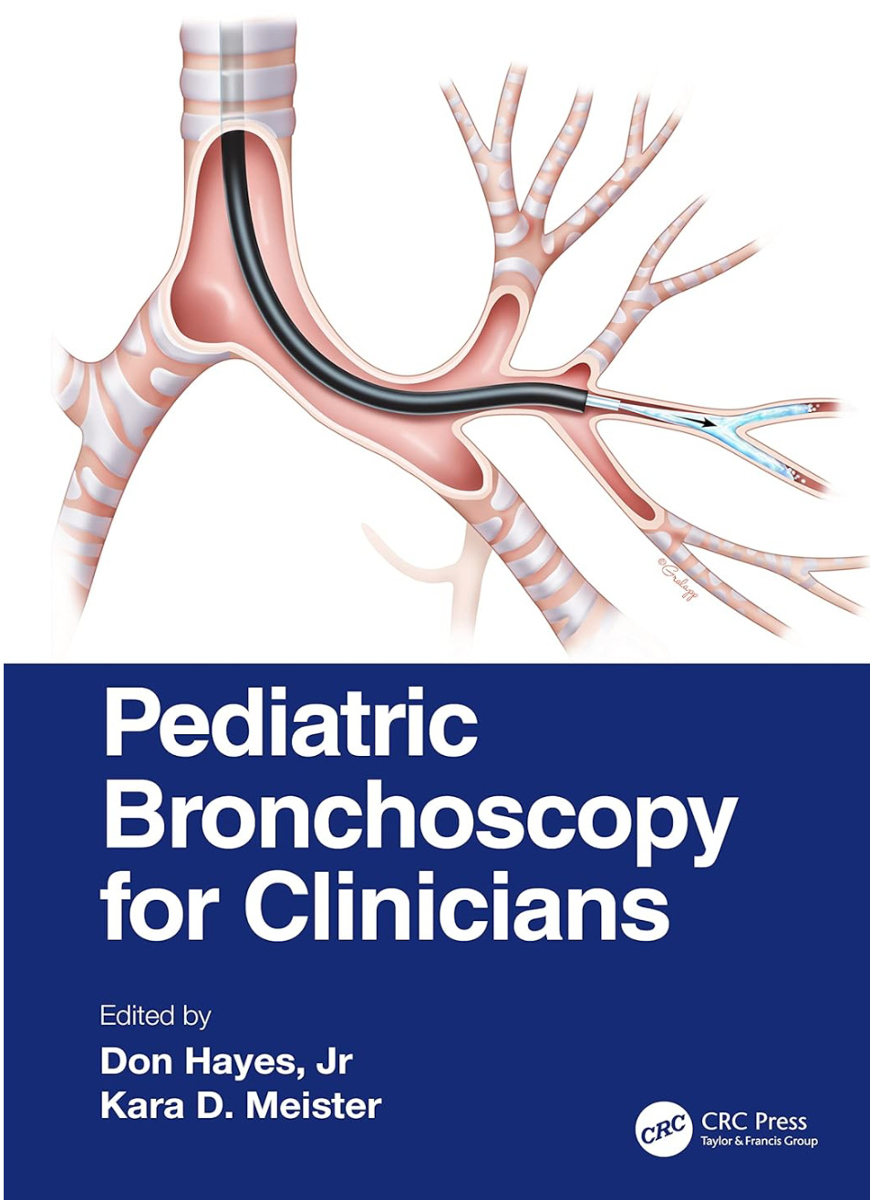 Pediatric Bronchoscopy for Clinicians 1st Edition