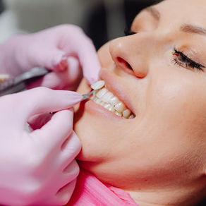 How Can Invisalign Fix Overbite, Crowding, or Gaps?