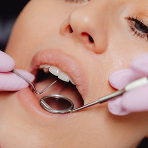 Winter Dental Care Tips for Healthy Teeth This Holiday Season