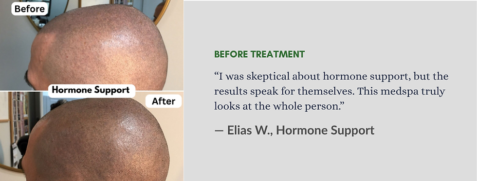 Hormone Support