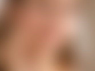 Eine Frau mit trockener Haut