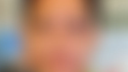 Positive Outlook for the School Vision Screening Project in 2022