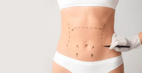 aesthetic body surgeon