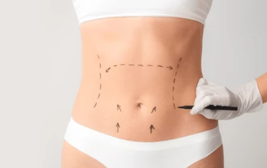 Aesthetic Body Surgery in Lebanon: Meet Dr. Antoine Abi Abboud
