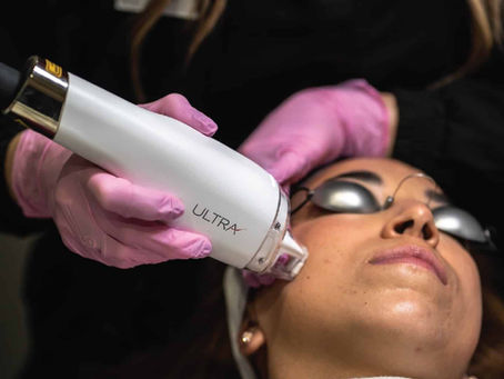 LaseMD Ultra Skin Resurfacing in Scottsdale