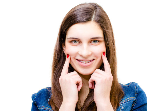 ¿Puedo hacerme ortodoncia si llevo coronas o implantes?