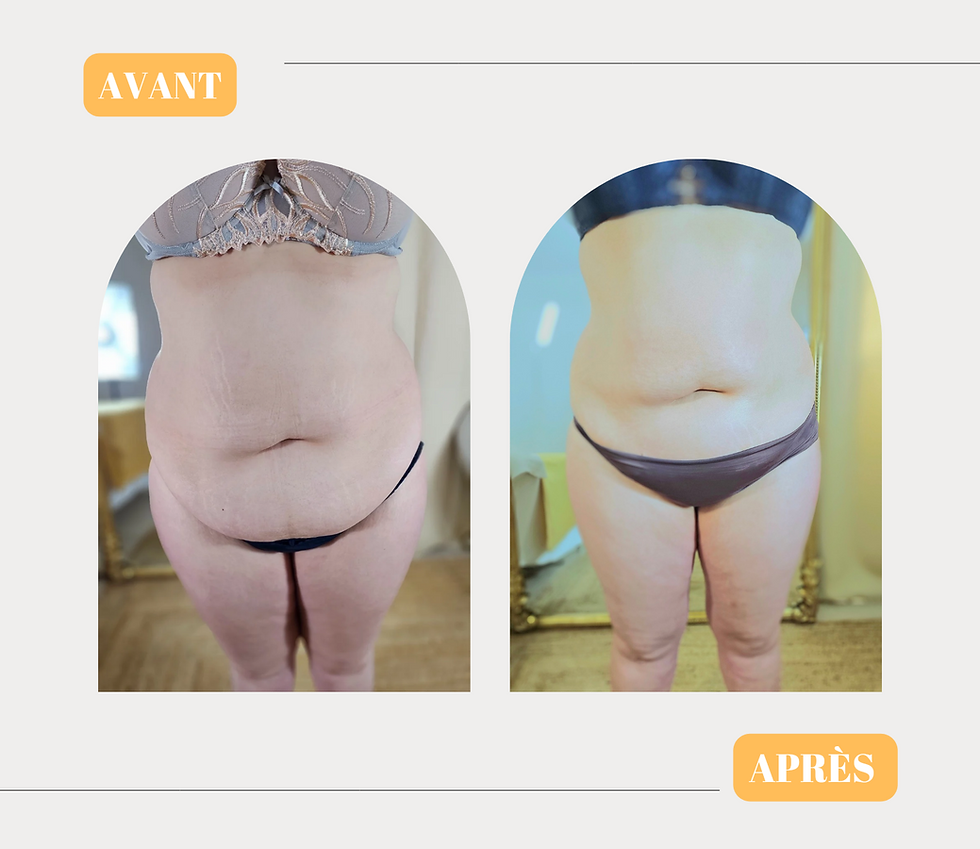 Minimalist Transformation Before + After Poster_20240926_025659_0000.png