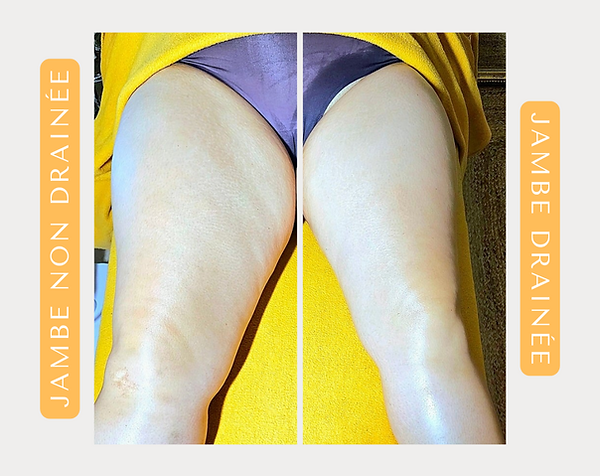 Grey Minimalist Before After Beauty Instagram Post_20240926_063321_0000.png
