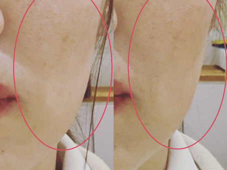 ビフォーアフターです(^^♪