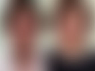 左右非対称も解消できます。