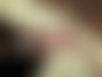 歯ぎしりに悩むあなたへ:効果的なマウスピースの選び方と活用法