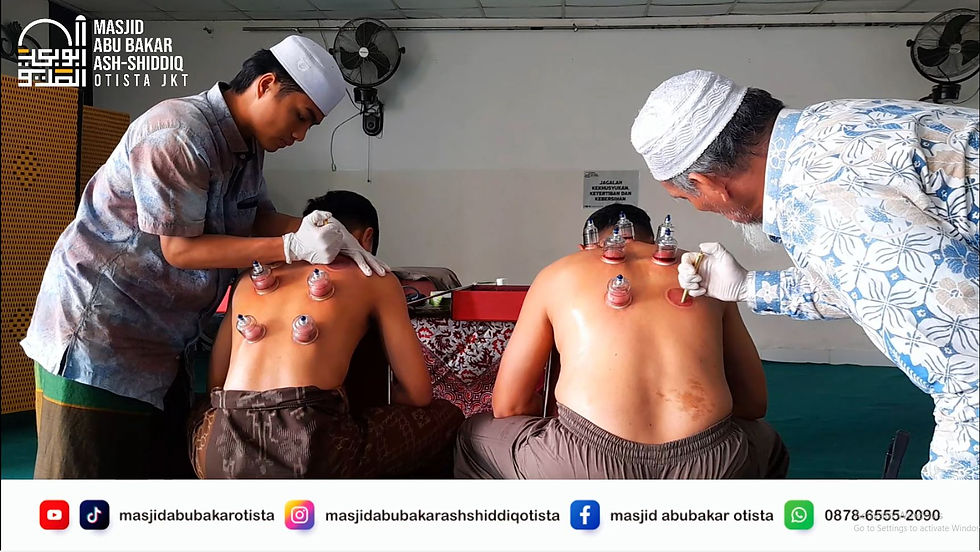 Pelatihan Bekam Masjid Abu Bakar Ash-Shiddiq Otista