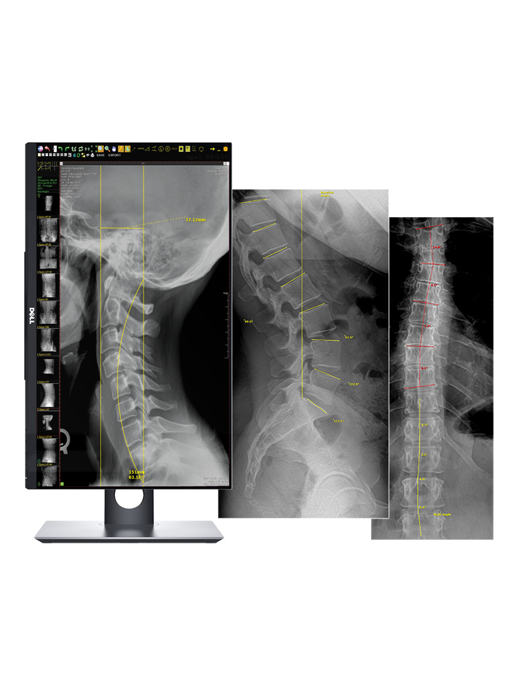 OPAL Chiro Software