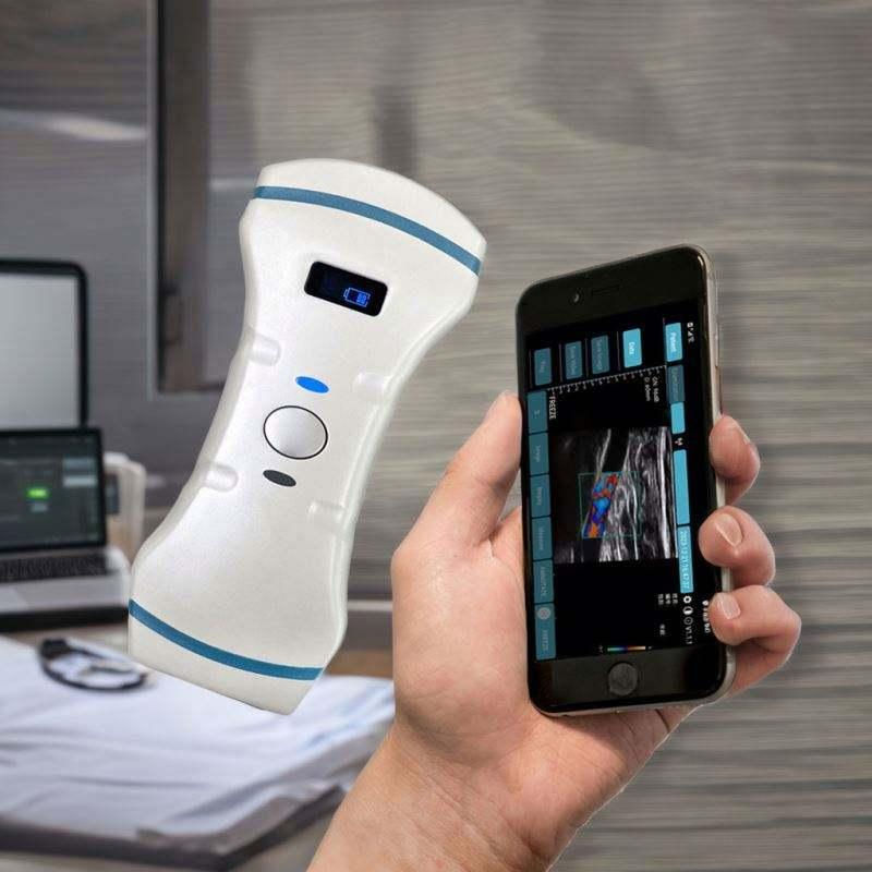 Hand holds a smartphone showing an ultrasound scan beside a white handheld medical device in a clinic room.