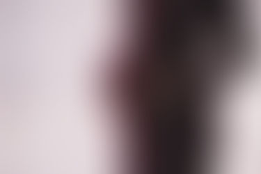 How to manage Cholestasis- itching in Pregnancy