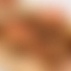 Corned beef potato skins