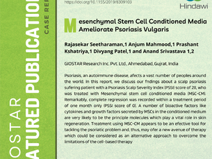 Mesenchymal Stem Cell Conditioned Media Ameliorate Psoriasis Vulgaris
