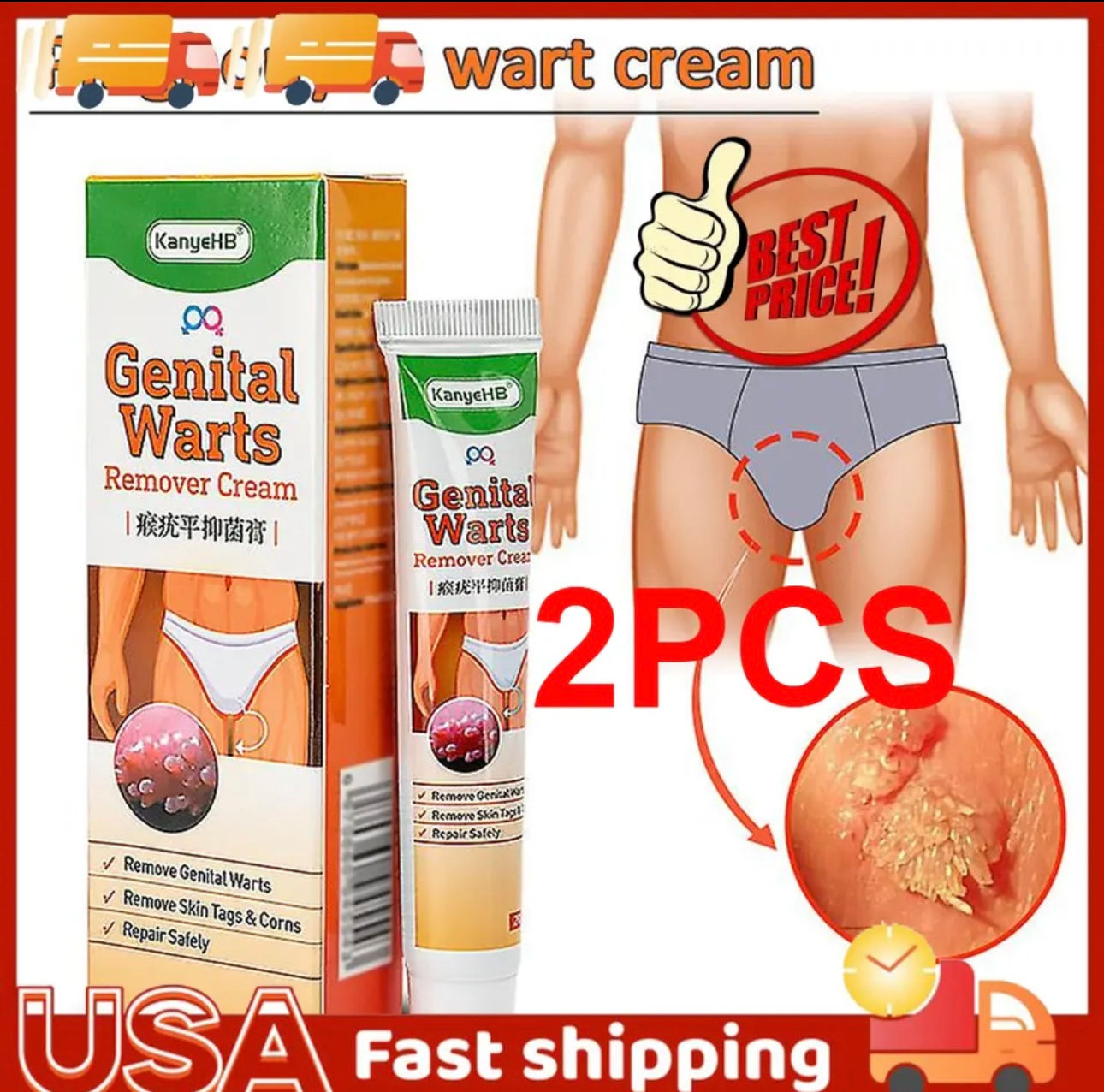 2x Wart Remover Genital Ointment Herpe Cream Acuminatum Antibacterial Treatment