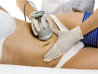 Elimina la celulitis con Radiofrecuencia