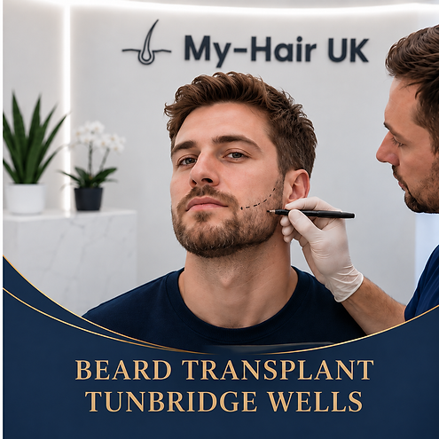 Beard Transplant for Tunbridge Wells Patients